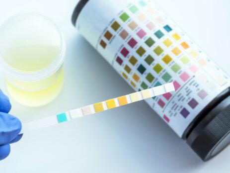 urine test